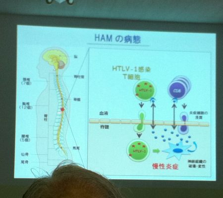 HAMについて